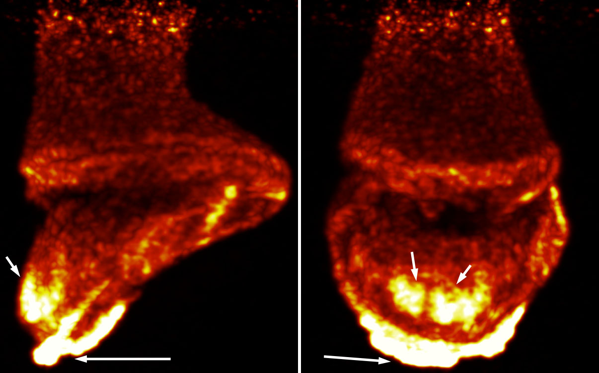 3D maximal intensity projection of the foot of a 15-year-old American Quarter Horse mare with severe laminitis.