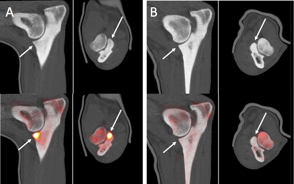 Multiplanar fused NaF PET and CT images of a 1-year-old Labrador dog with pain in the right elbow.