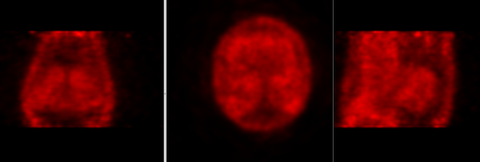 PET scan images of the fetlock using the MILE-PET scanner at UC Davis veterinary hospital