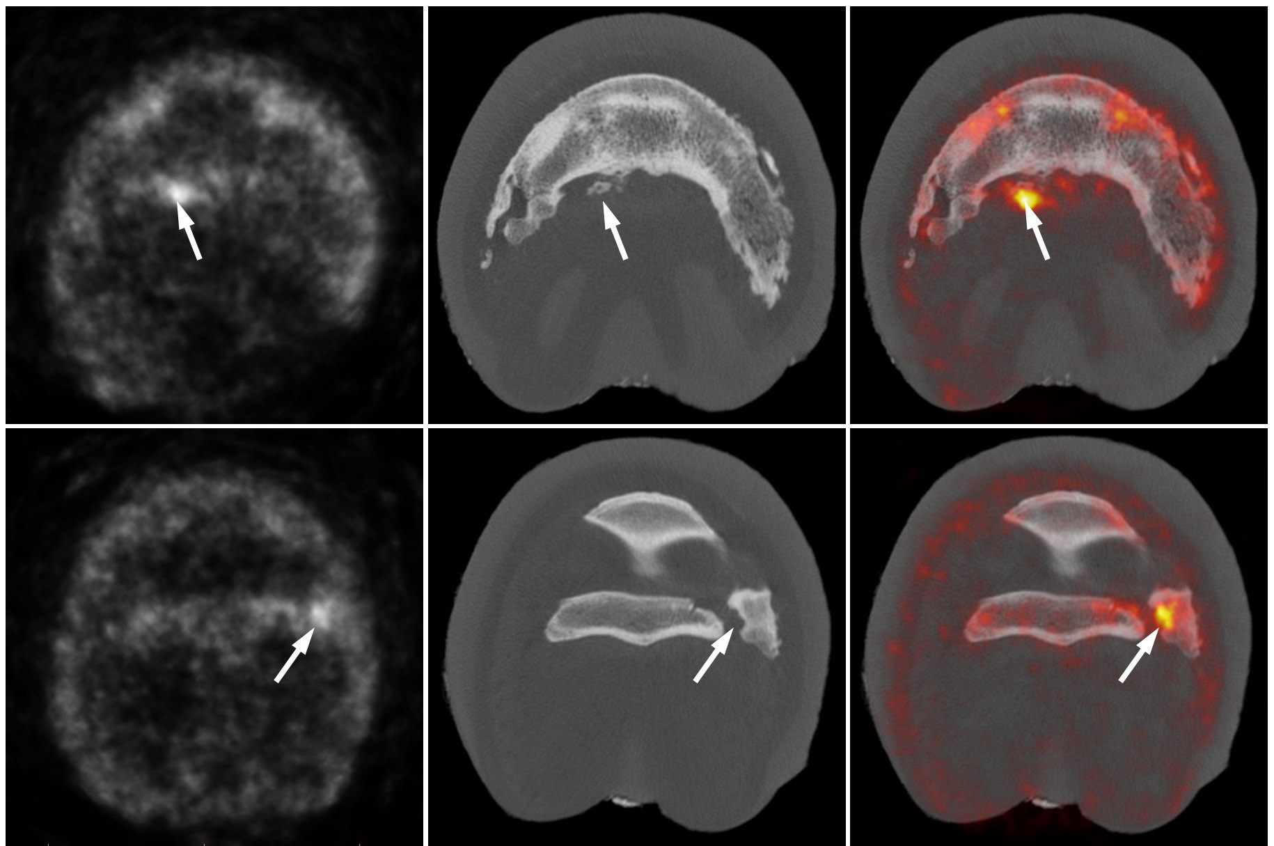 Positron Emission Tomography (PET)