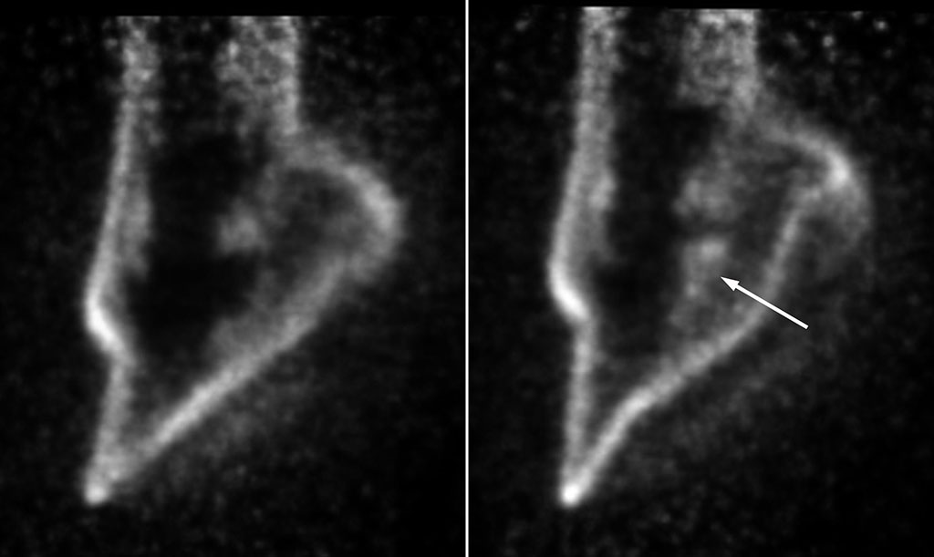 Sagittal PET images