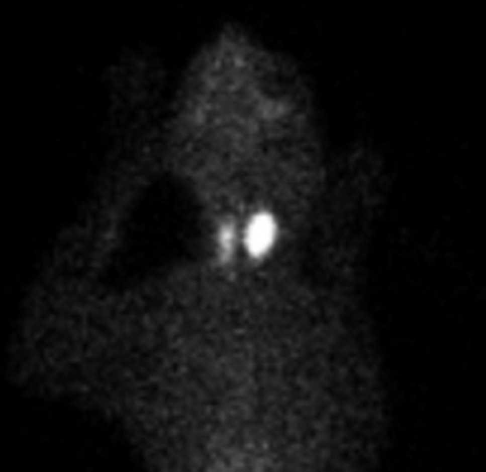 Nuclear Scintigraphy