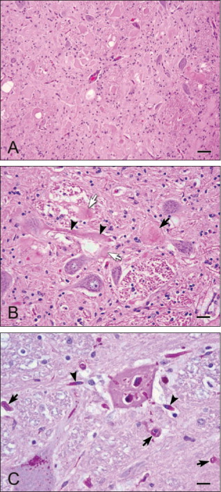 Histopathological phenotype of horses affected by eNAD/EDM. Aleman et al., 2011