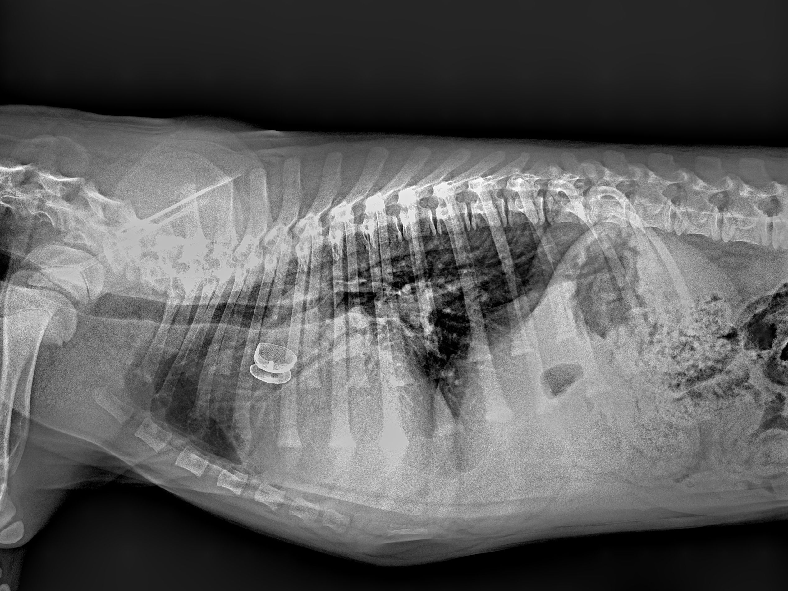 x-ray showing ACDO placed in Riley's chest