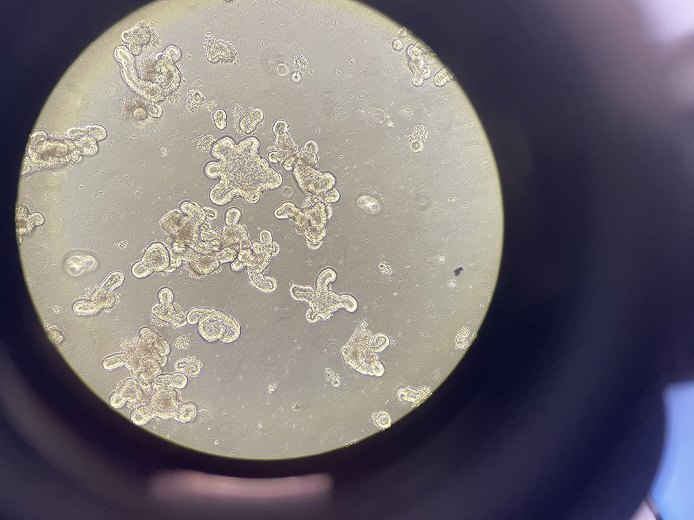 Microscopic image of growth in a petri dish.