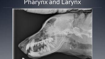 Anatomy of the pharynx and larynx