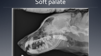 Soft palate