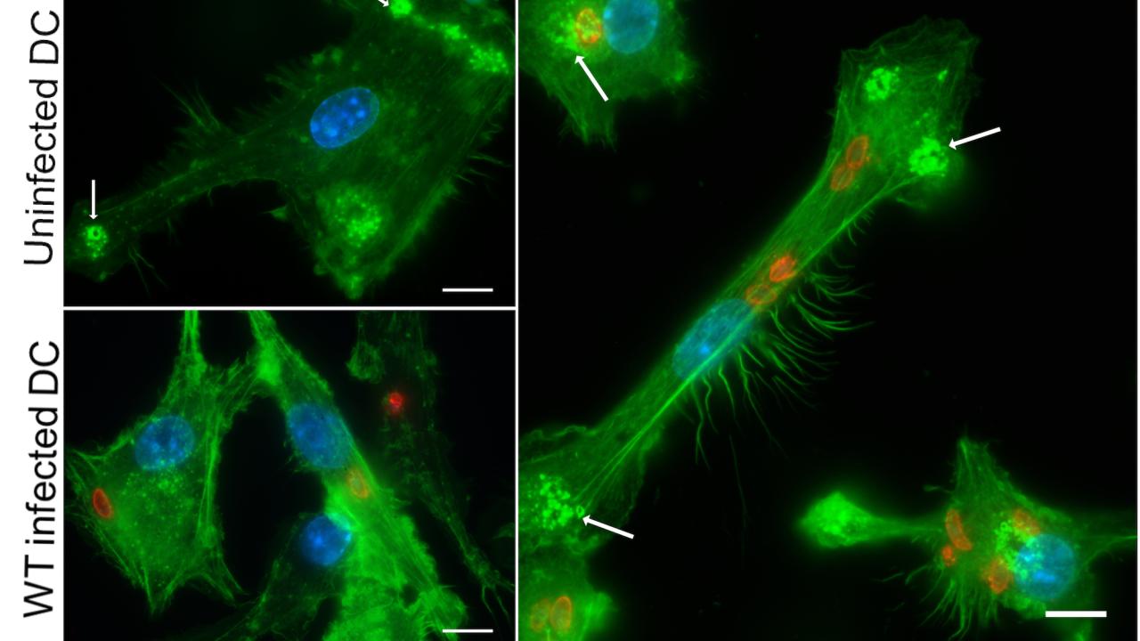 Dendritic cells have “podosomes” or feet that help them stay put (bright green blobs, arrowed). When infected with Toxoplasma (lower left), these go away, allowing the parasite to hijack the cells to migrate around the body. Removing TgWIP gene from the parasite restores the dendritic cells’ feet and stops the hijacking of the cell by the parasite. (Jeroen Saeij, UC Davis) microscopic images of Toxoplasma