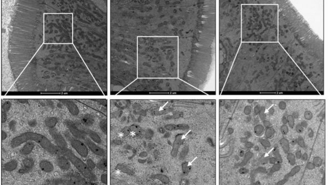 Microscopic images showing protective effects of L. plantarum on mitochondrial structure and density in SIV-infected gut. 