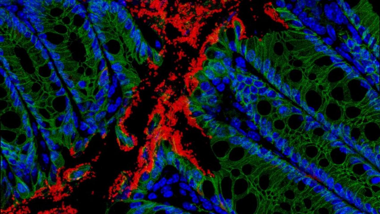 neuroimmune interactions