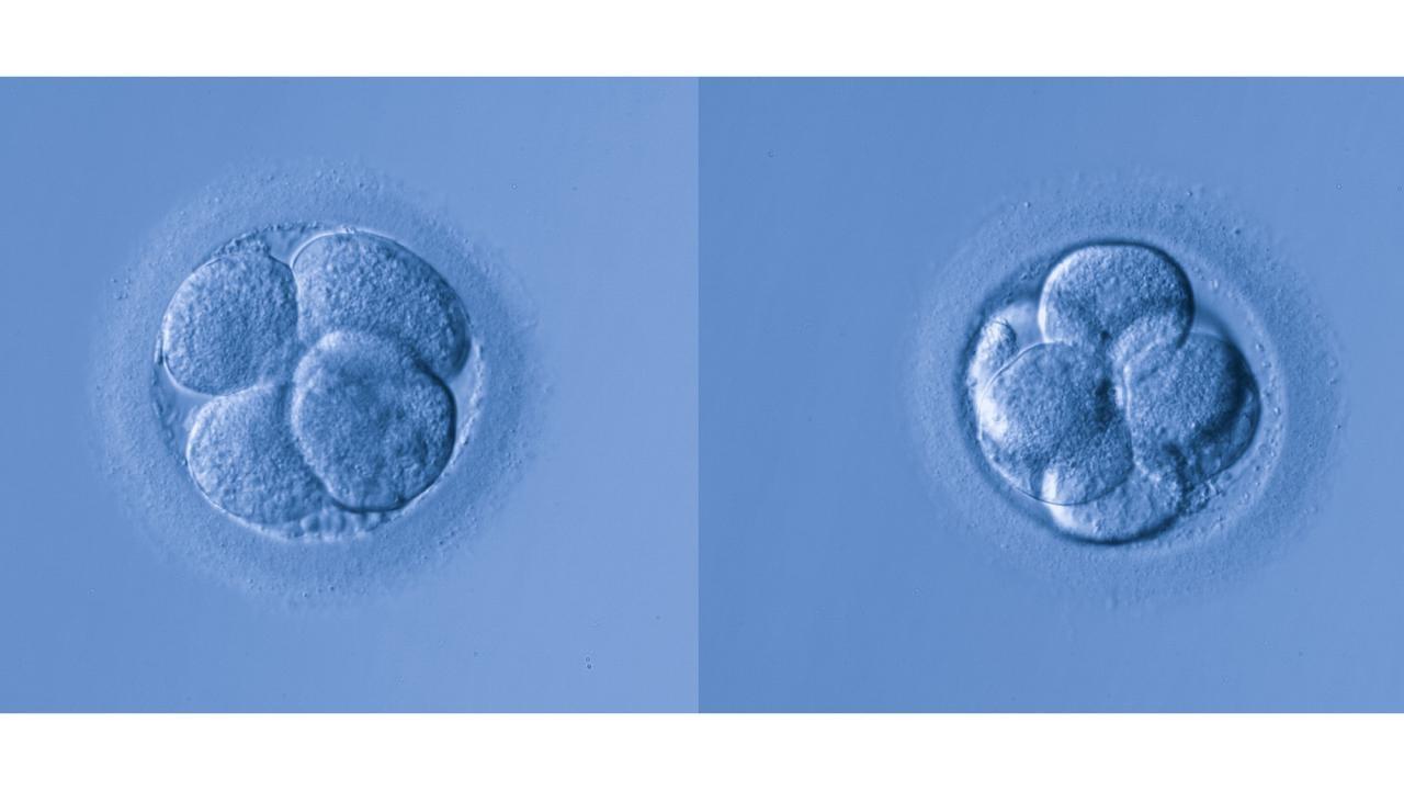 Early stage embryos created by IVF