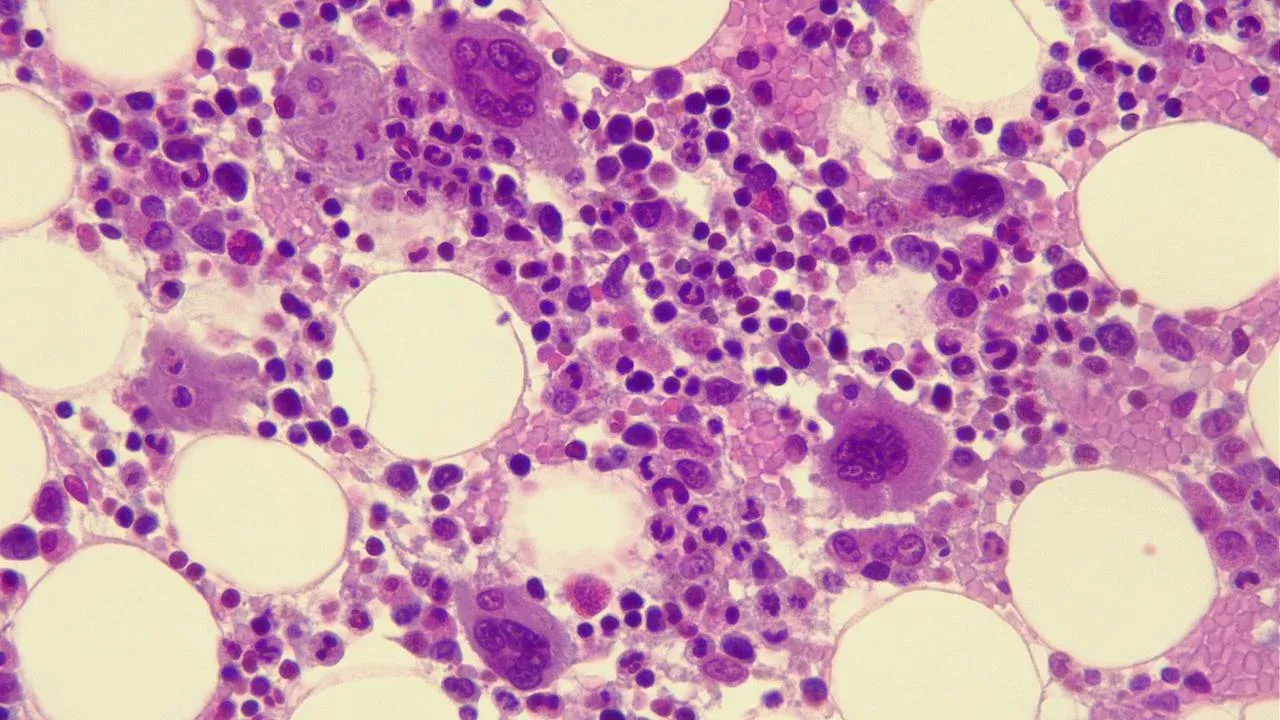 Human bone marrow under the microscope