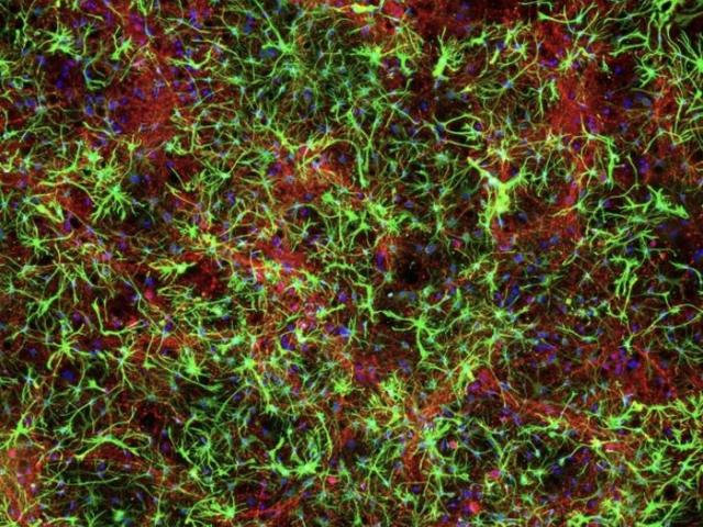 Image of a fluorescence micrograph: green filamentous networks over red matrix with scattered blue nuclei