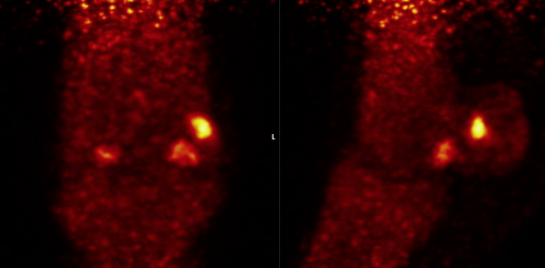 PET scan images of horse's ankle