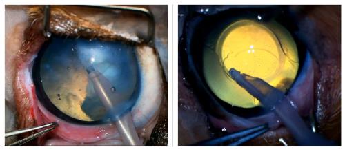 intraoperative photos of cataract surgery