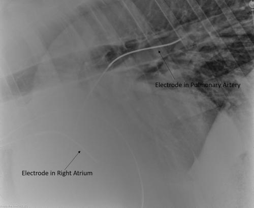 image of horse's chest with electrodes in it