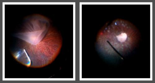 microscopic images of inside eye