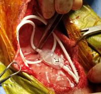 surgery image of a shunt being placed in dog