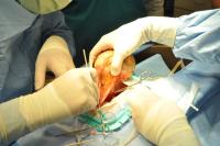 tumor being removed from fish