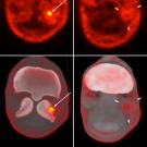 NaF PET and fused PET CT transverse images of the fetlock of a 6-year-old Warmblood horse.