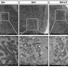 Microscopic images showing protective effects of L. plantarum on mitochondrial structure and density in SIV-infected gut. 