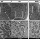 Microscopic images showing protective effects of L. plantarum on mitochondrial structure and density in SIV-infected gut. 