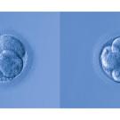 Early stage embryos created by IVF