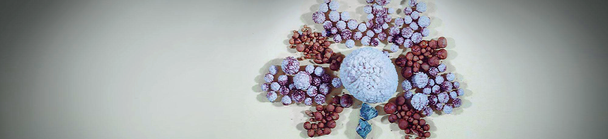 Urinary stones formed into the shape of a flower.